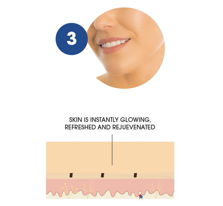 How the Manicare dermaSMOOTH works